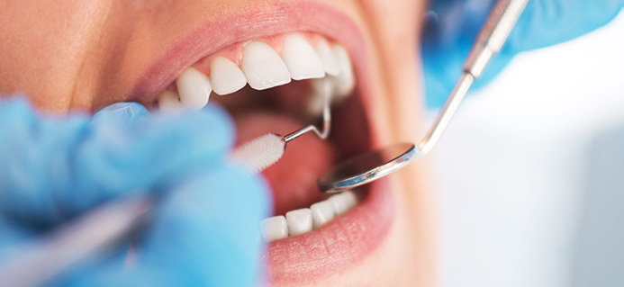 Si no existe dolor, no hay que ir al dentista Si no existe dolor, no hay que ir al dentista