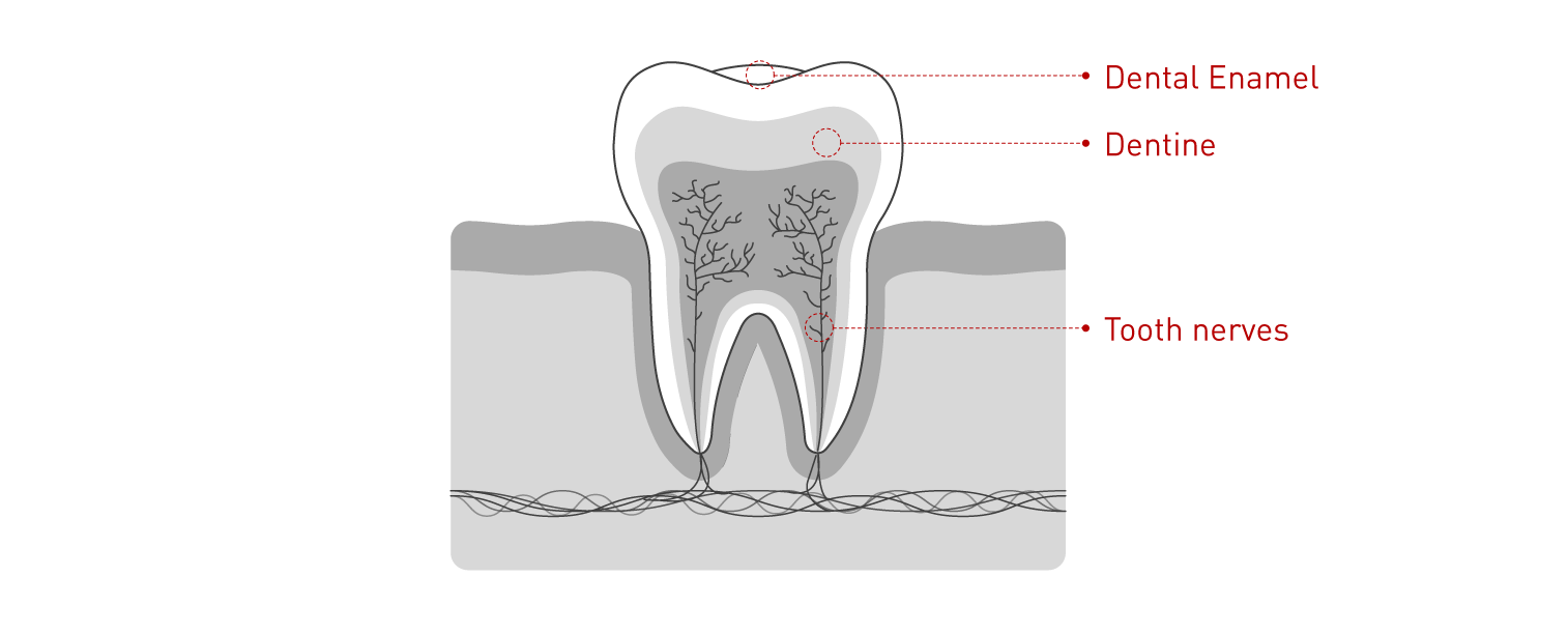 Blanqueamiento dental