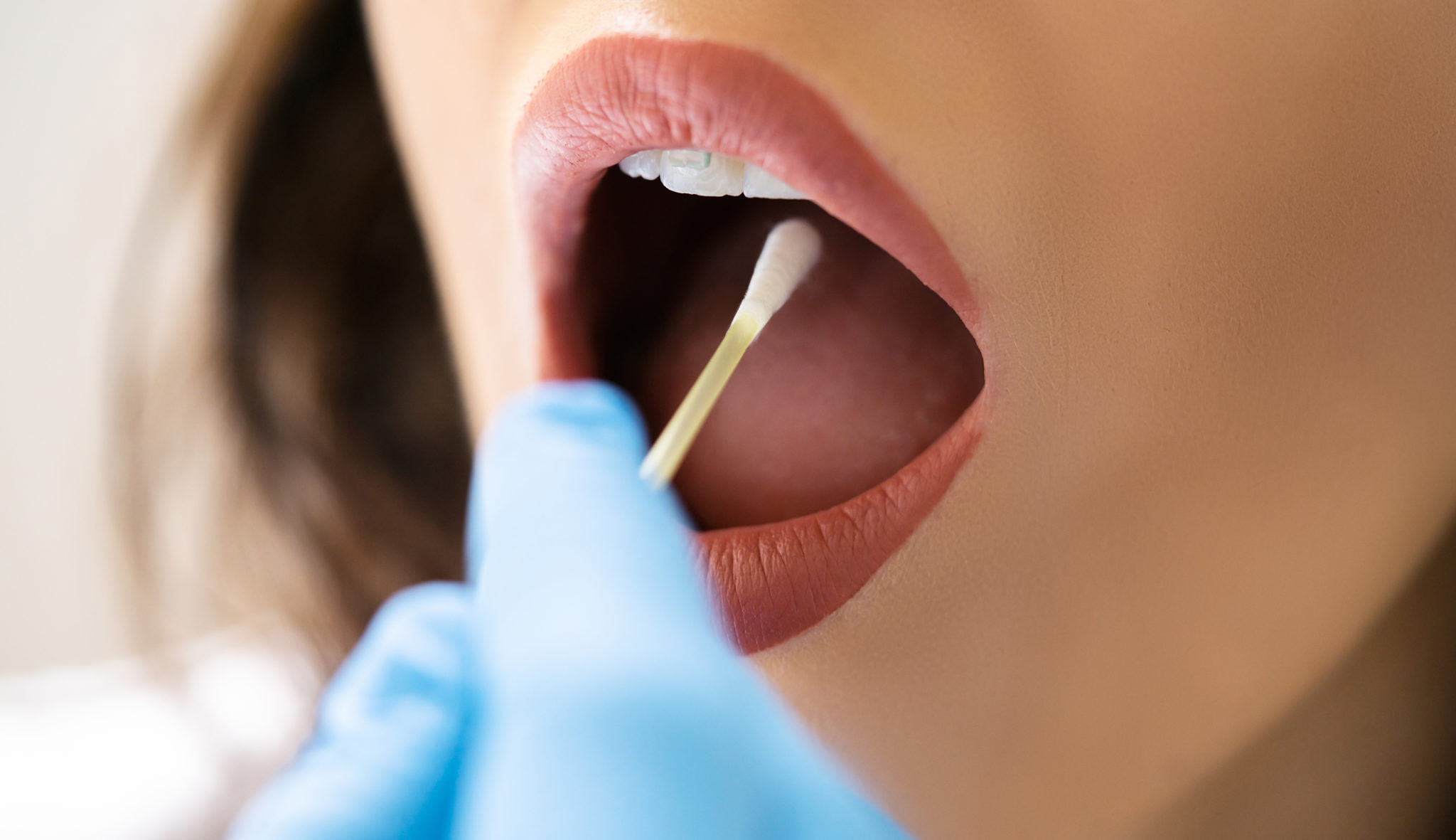 ¿Qué bacterias <em>buenas</em> y <em>malas</em> hay en nuestra boca?