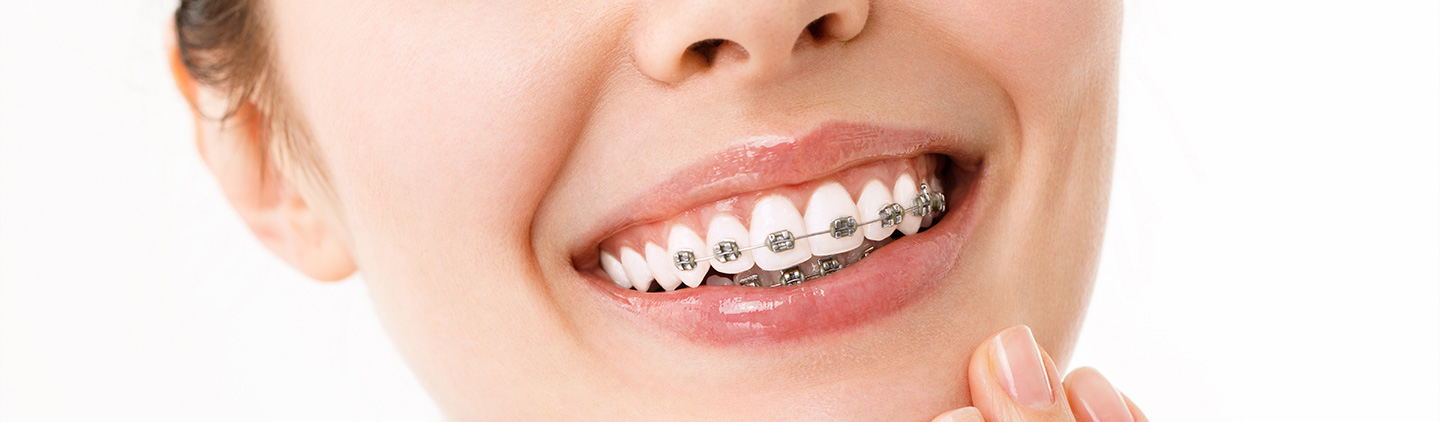 La ortodoncia: ¿salud o solo estética?