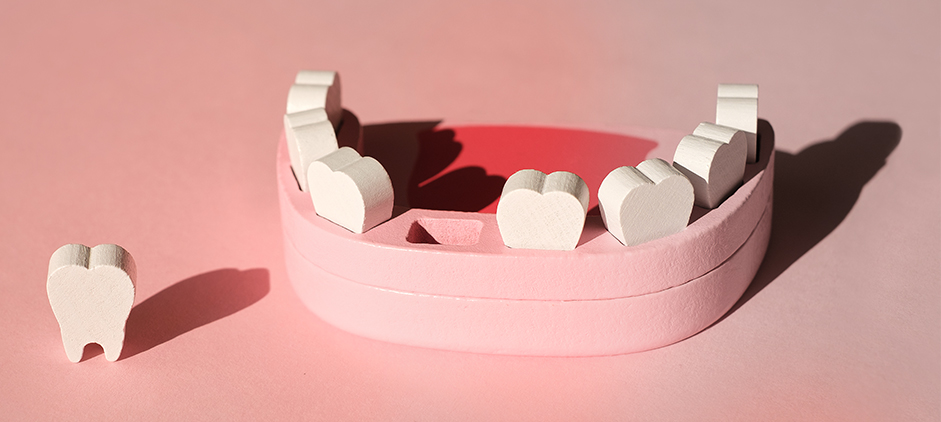 perdida de dientes